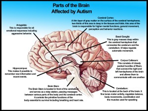 Parts-of-the-brain-affected-by-autism-No-logo3