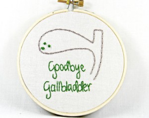 goodbyegallbladder